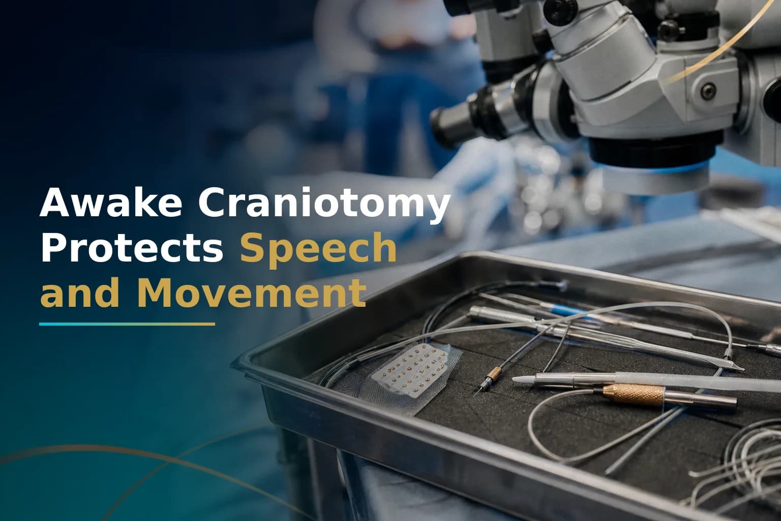 Awake Craniotomy for Glioblastoma: Speech and Motor Mapping