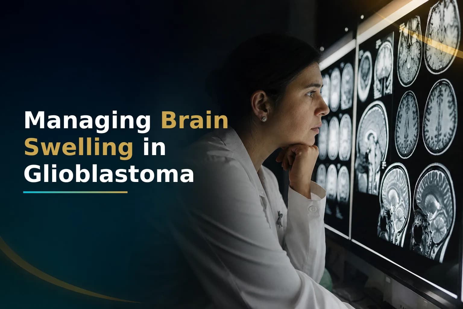Glioblastoma Brain Edema: Causes and Treatment