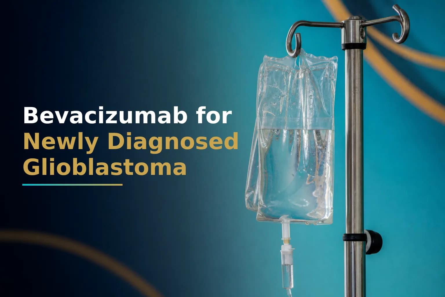Bevacizumab for Newly Diagnosed Glioblastoma: Should You Add Anti-Angiogenic Therapy?
