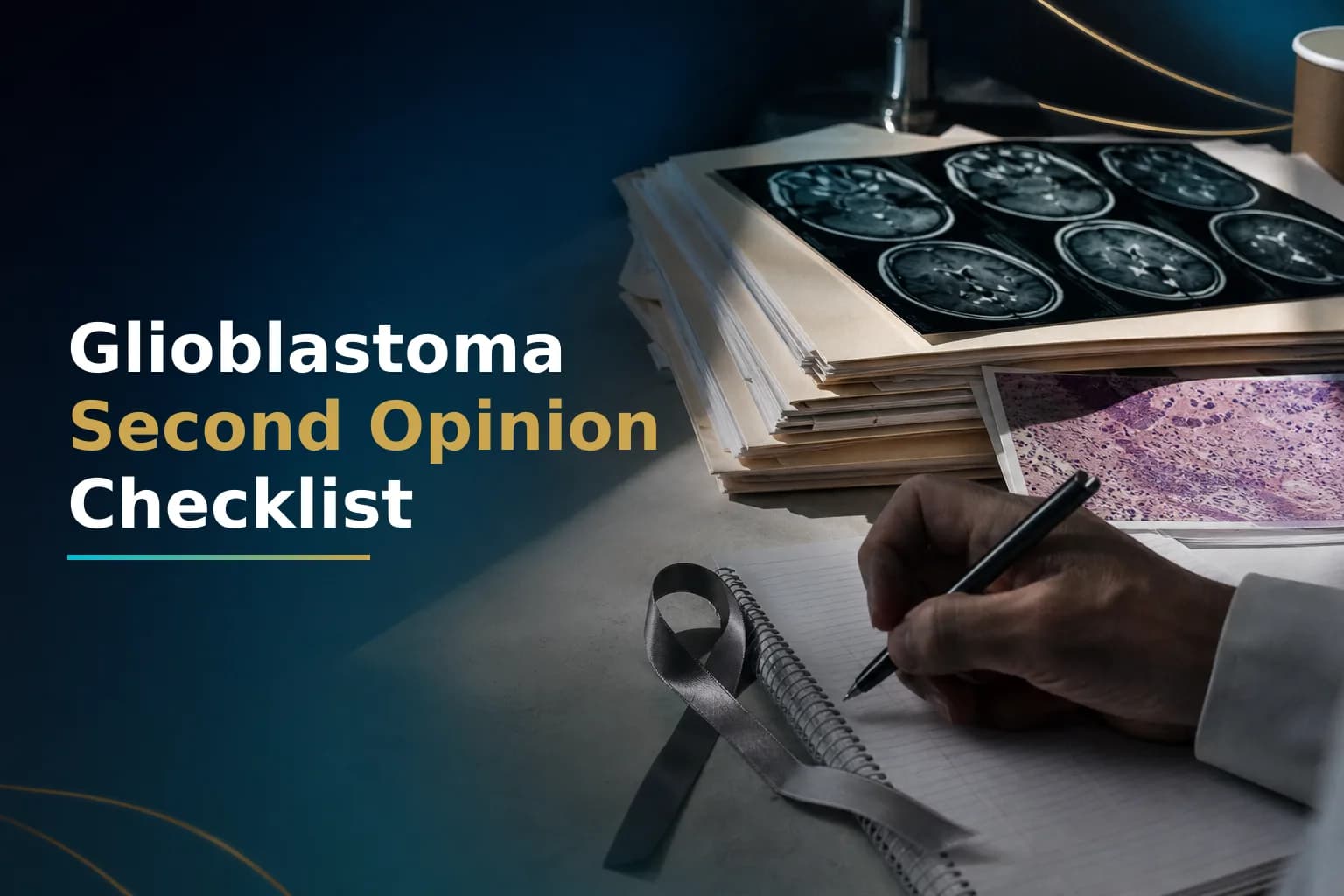 How to Prepare for a Glioblastoma Second Opinion