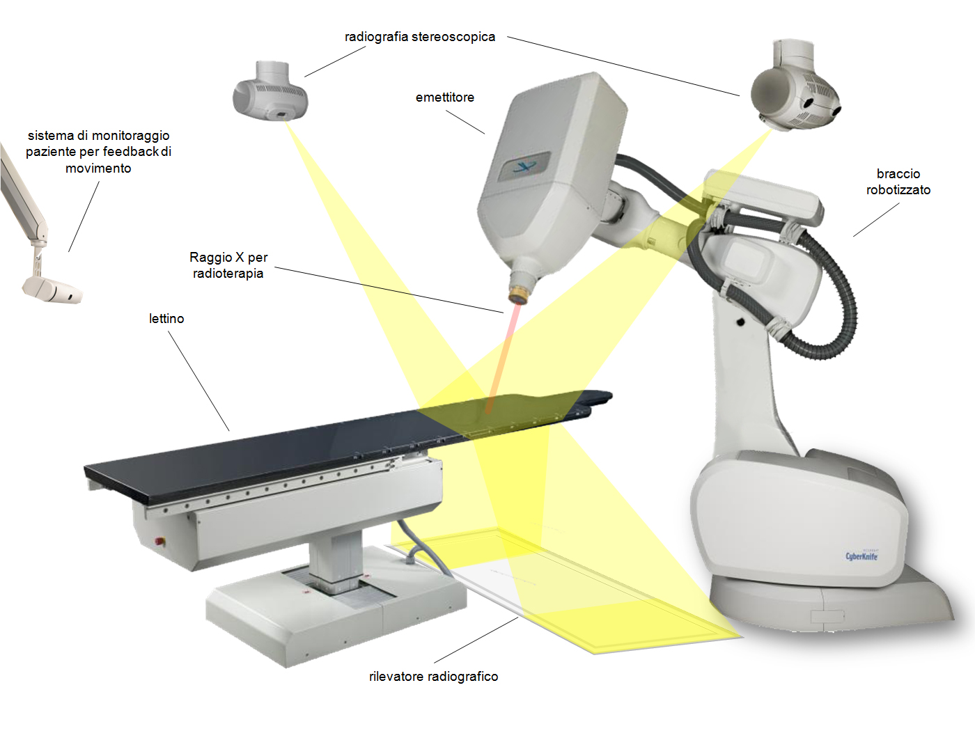 CyberKnife robotic radiosurgery system